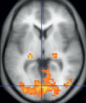 Functional Magnetic Resonance Imaging (Chapter 5) - Brain Imaging