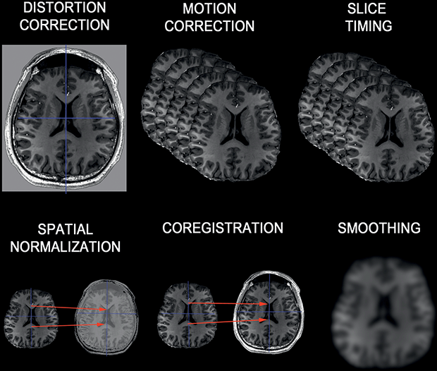 Functional Magnetic Resonance Imaging (Chapter 5) - Brain Imaging