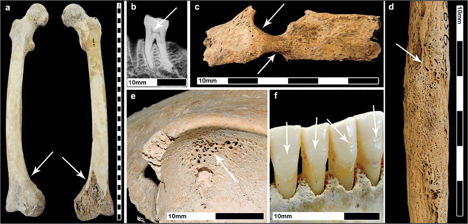 Figure 10