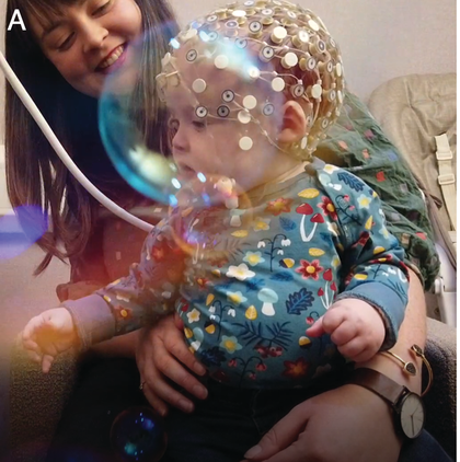 A photograph of a child wearing an E E G cap that measures brain waves. See long description.