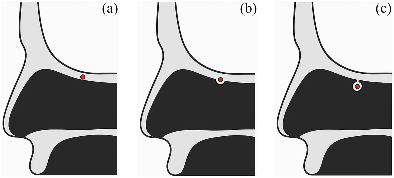 Figure 0