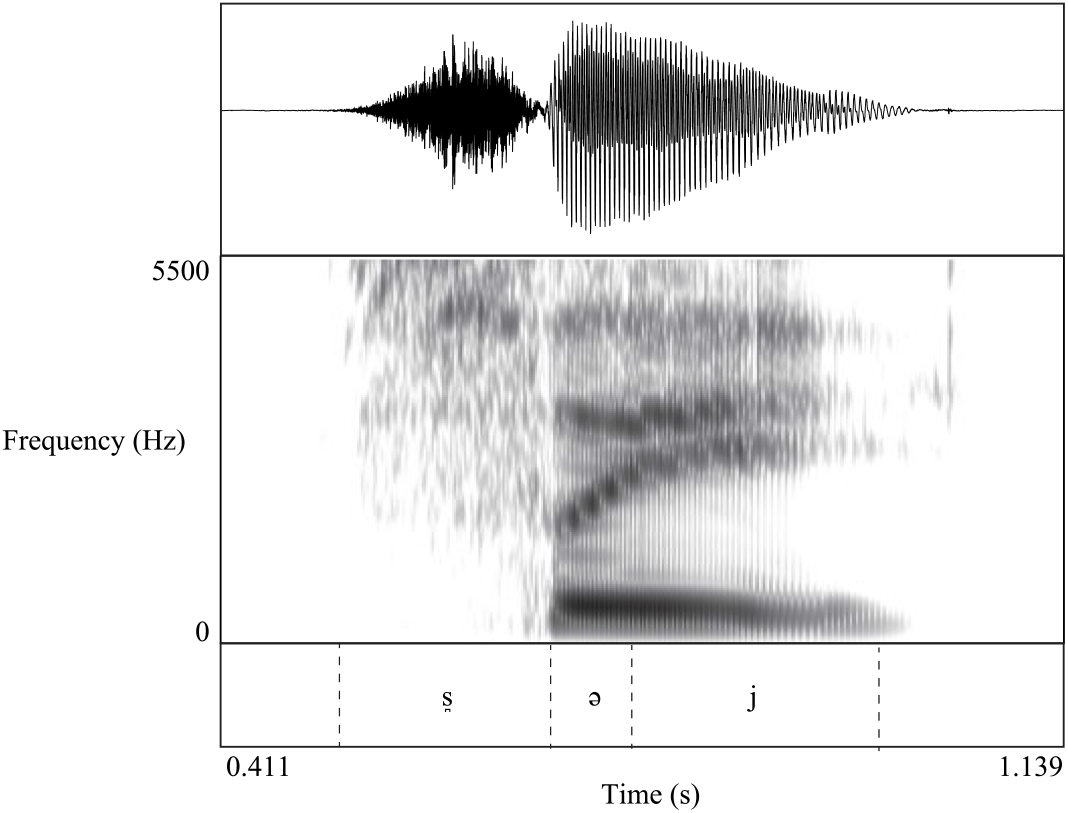 Figure 11