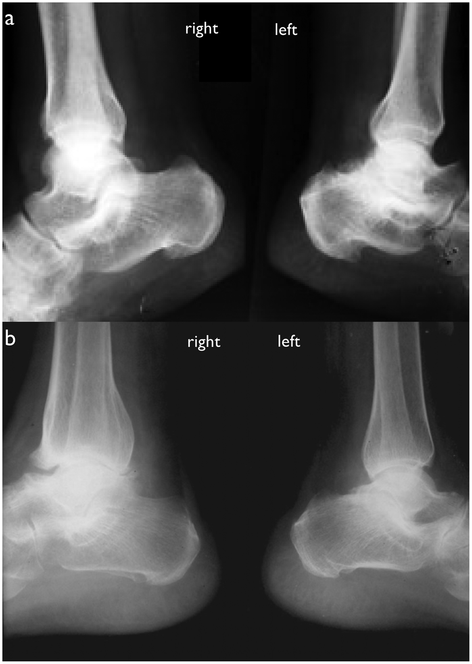 Figure 14