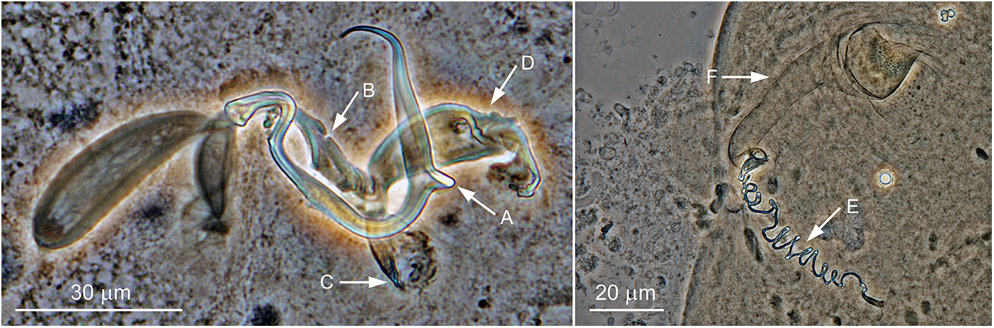 A composite micrograph with two labeled views of a curved structure on a gray background, with arrows and scale bars. See long description.