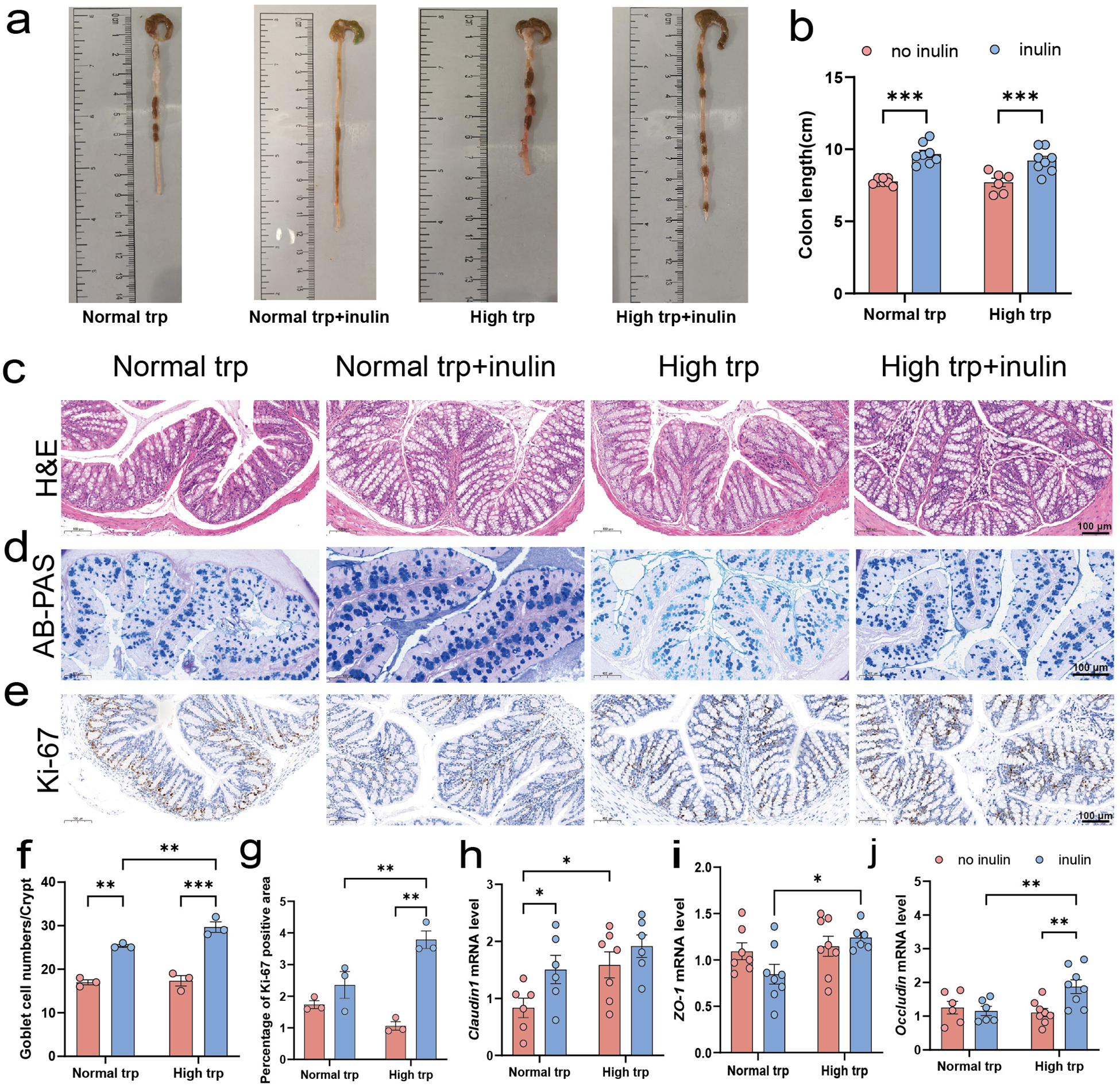 Scientific figure showing colonic changes with tryptophan and inulin, highlighting colon length, goblet cell density and gene expression. See long description.