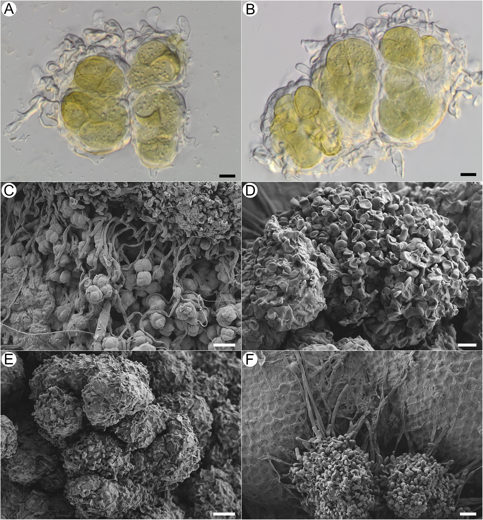 Six-panel micrograph series showing Acantholichen frullaniae granule development and hyphal structure using light and S E M microscopy. See long description.