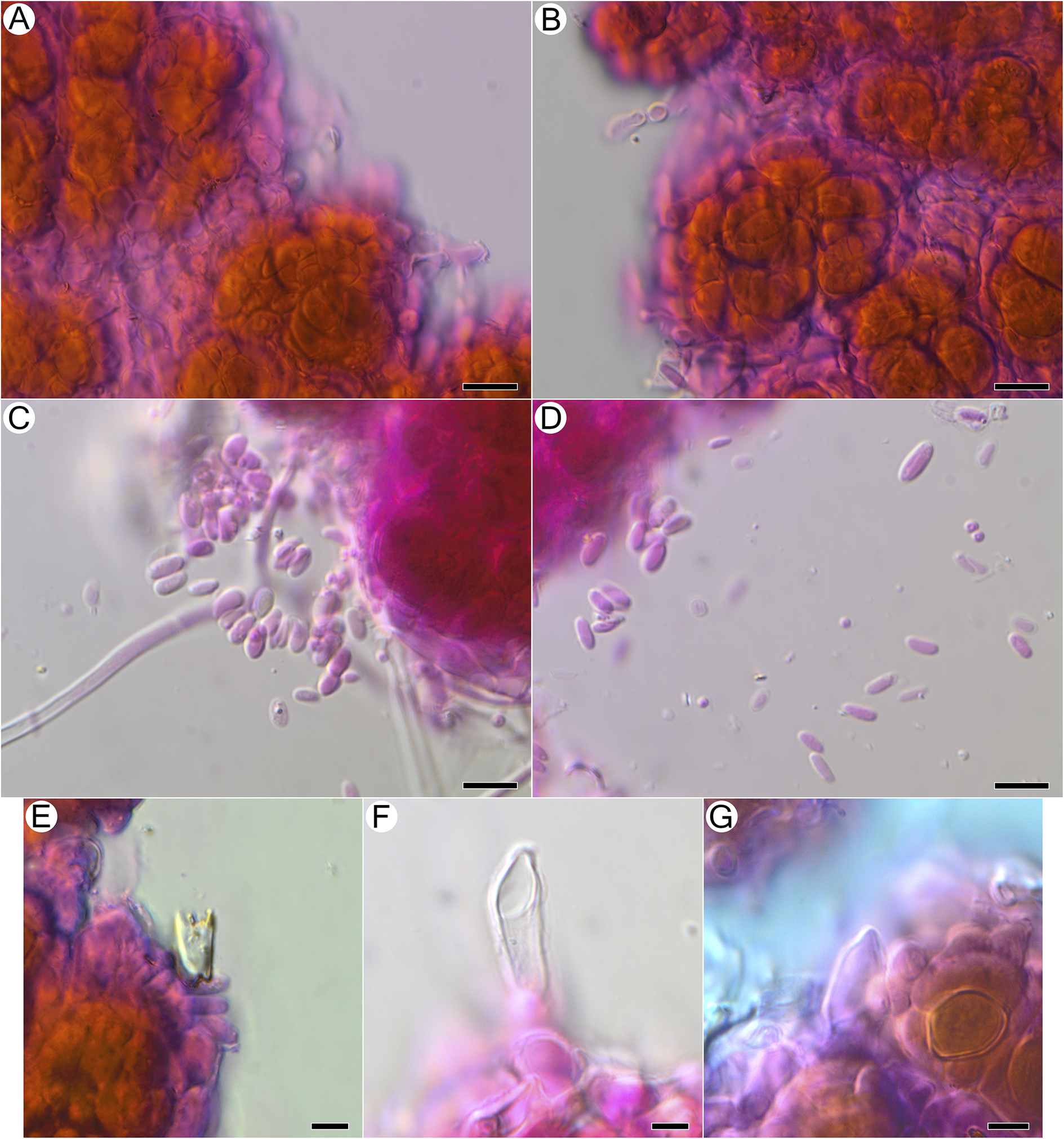 Seven-panel photomicrograph showing hyphae wrapping photobiont cells, putative basidiospores, and basidia in Acantholichen frullaniae after K O H and phloxine B staining. See long description.