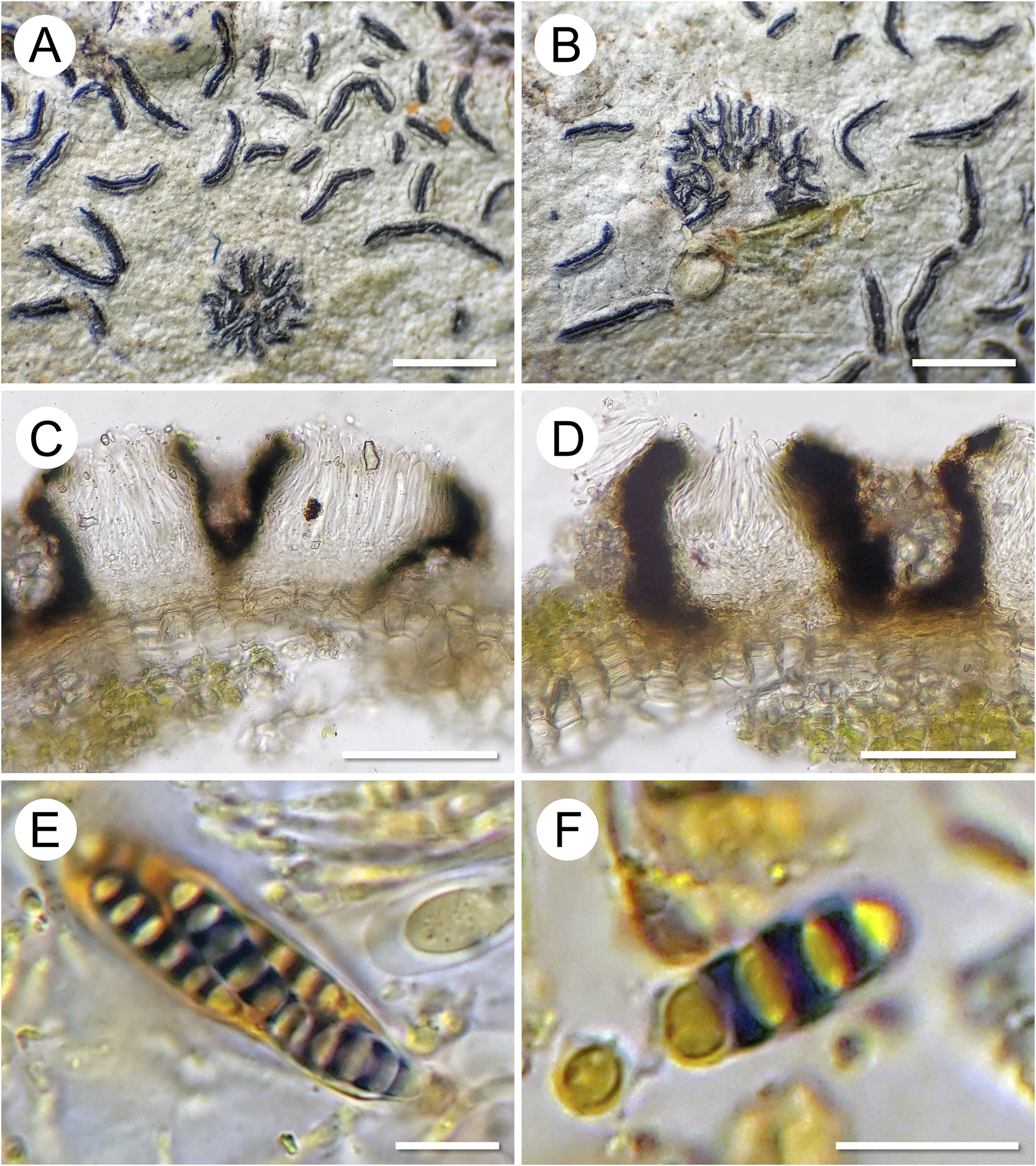 Six-panel photo montage
showing external and microscopic features of Graphis epigraphis,
including lirellae, hymenium, excipulum, asci, and ascospores. See
long description.