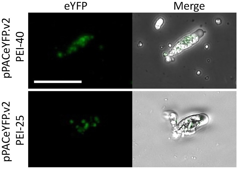 Composite micrographs with green fluorescence and merged brightfield views in two rows. See long description.