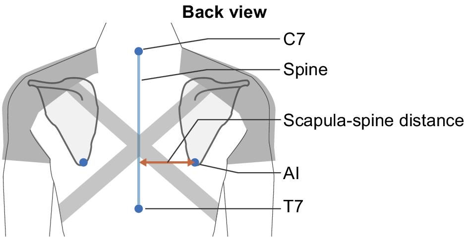 Schematic showing back view with labeled points C7, T7, AI, and arrows indicating spine and scapula-spine distance.