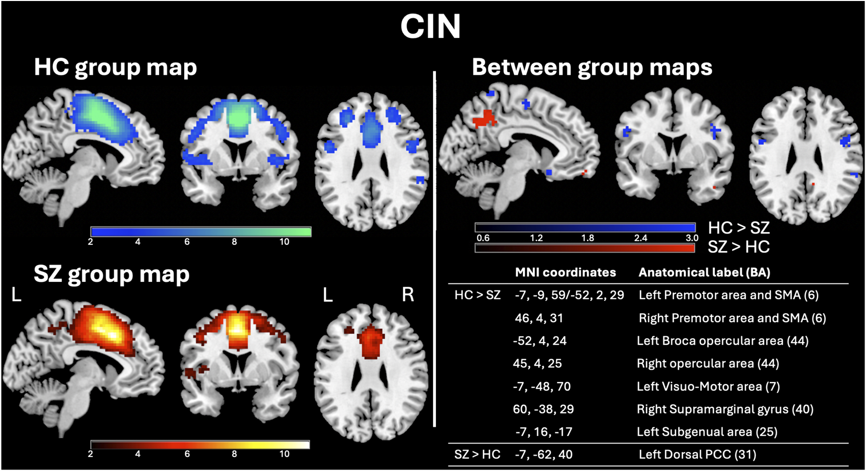 Brain maps of the Cingulo Insular Network (CIN) in healthy controls (blue) and schizophrenia patients (red/yellow), plus between-group differences maps and related coordinates table. See long description.