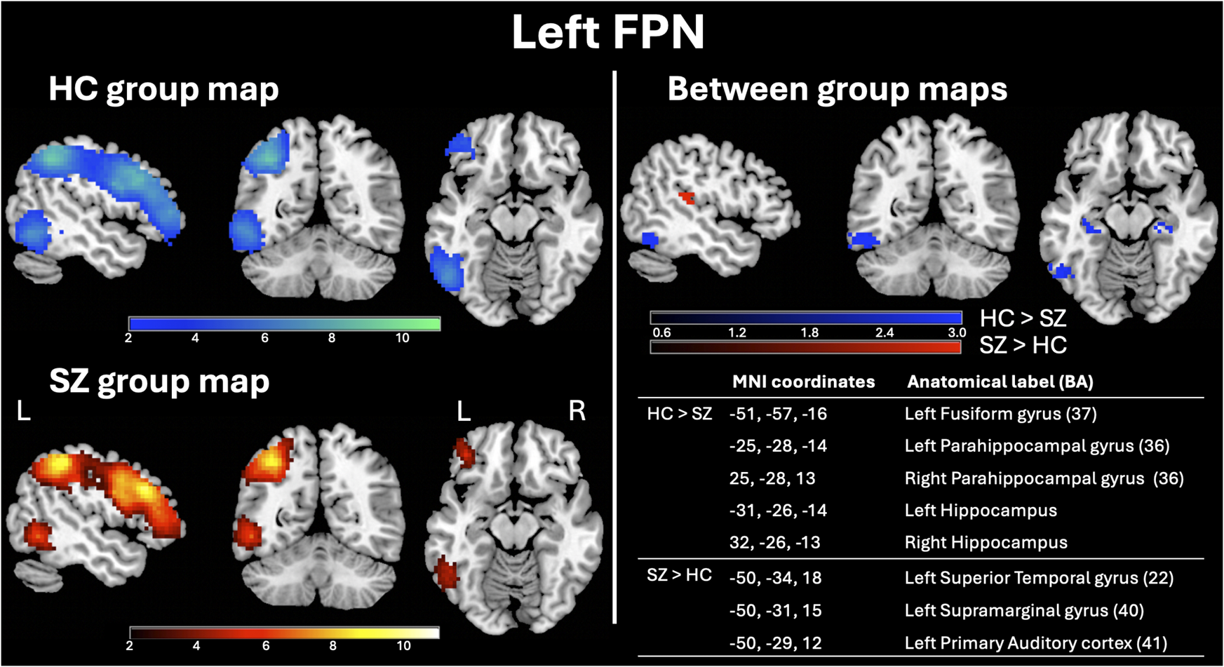 Brain maps of the Left Frontoparietal network (FPN) in healthy controls (blue) and schizophrenia patients (red/yellow), plus between-group differences maps and related coordinates table. See long description.
