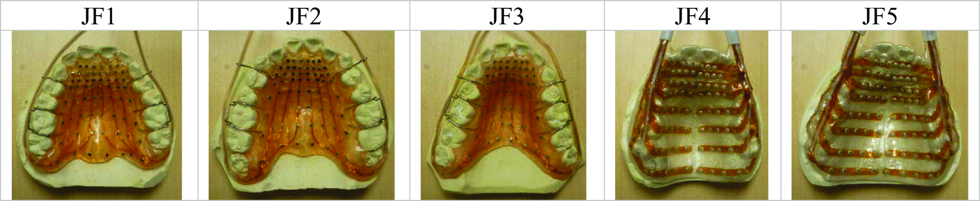Five artificial palates with different EPG patterns.