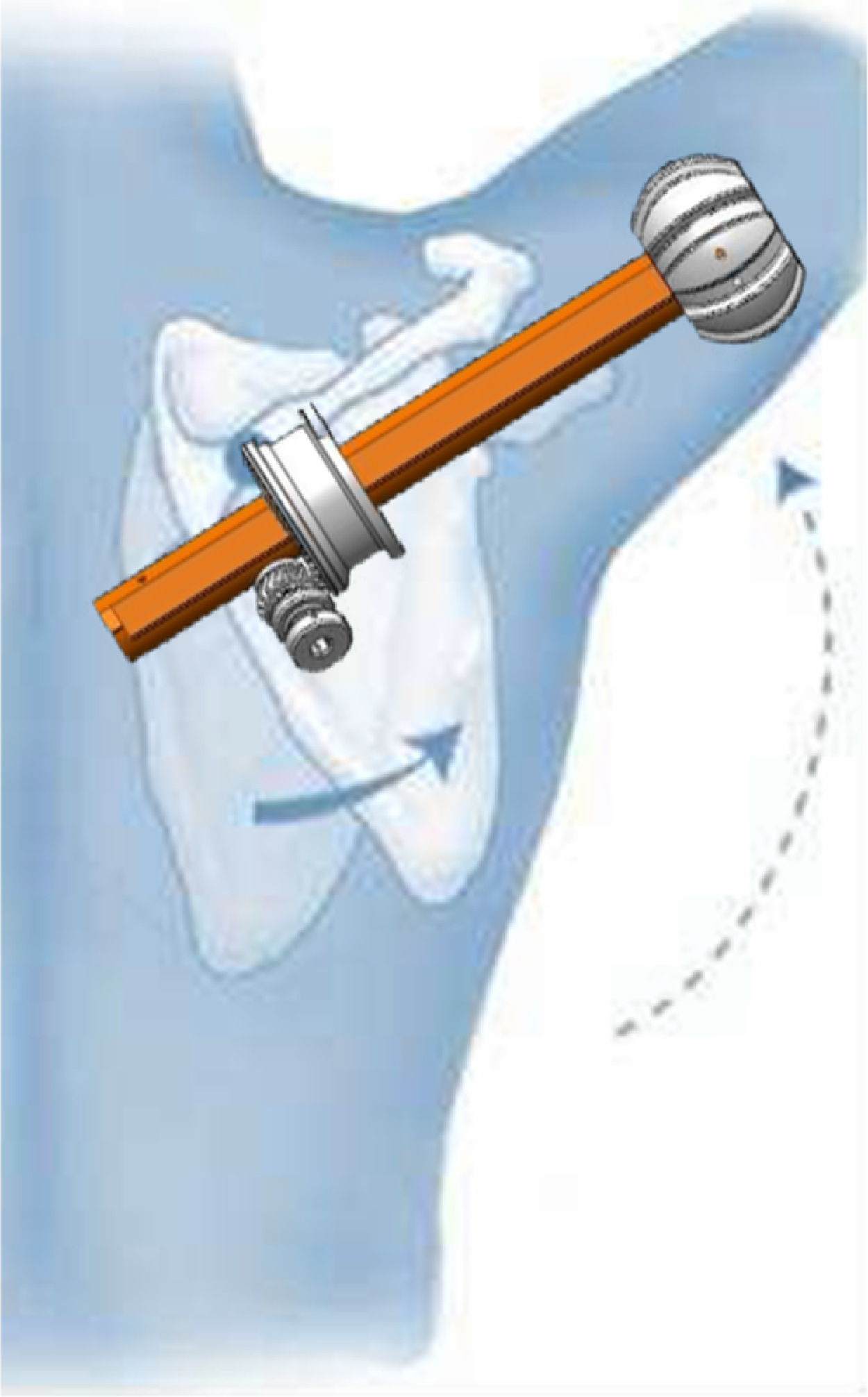 A diagram of an exoskeleton shoulder joint mechanism.