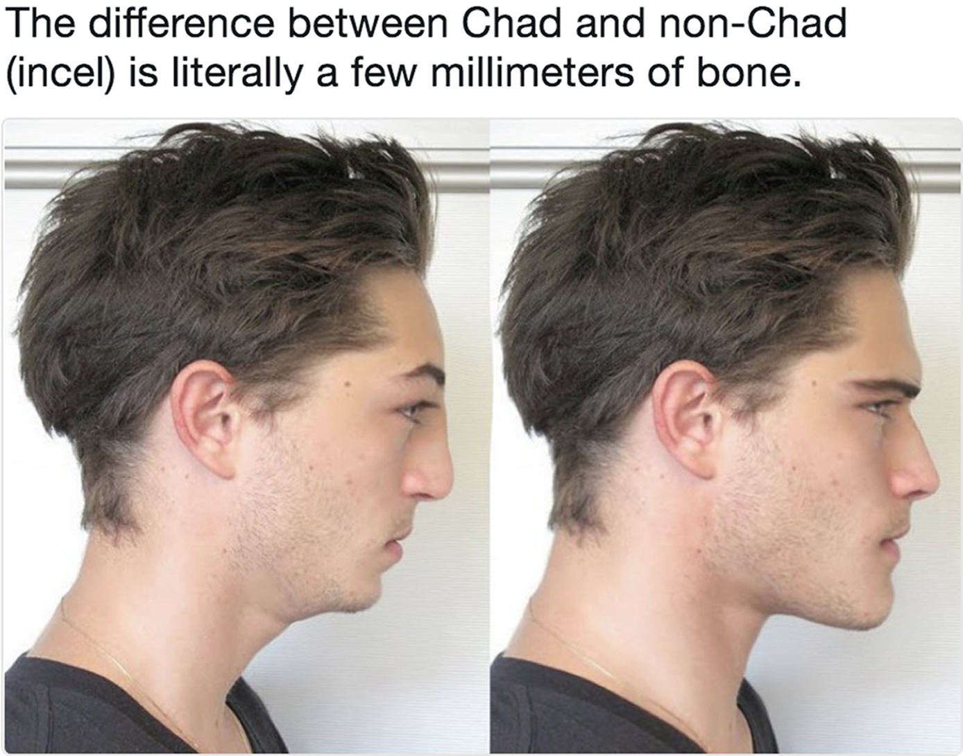 Two side-by-side photos of young men in profile, highlighting subtle differences in facial features.