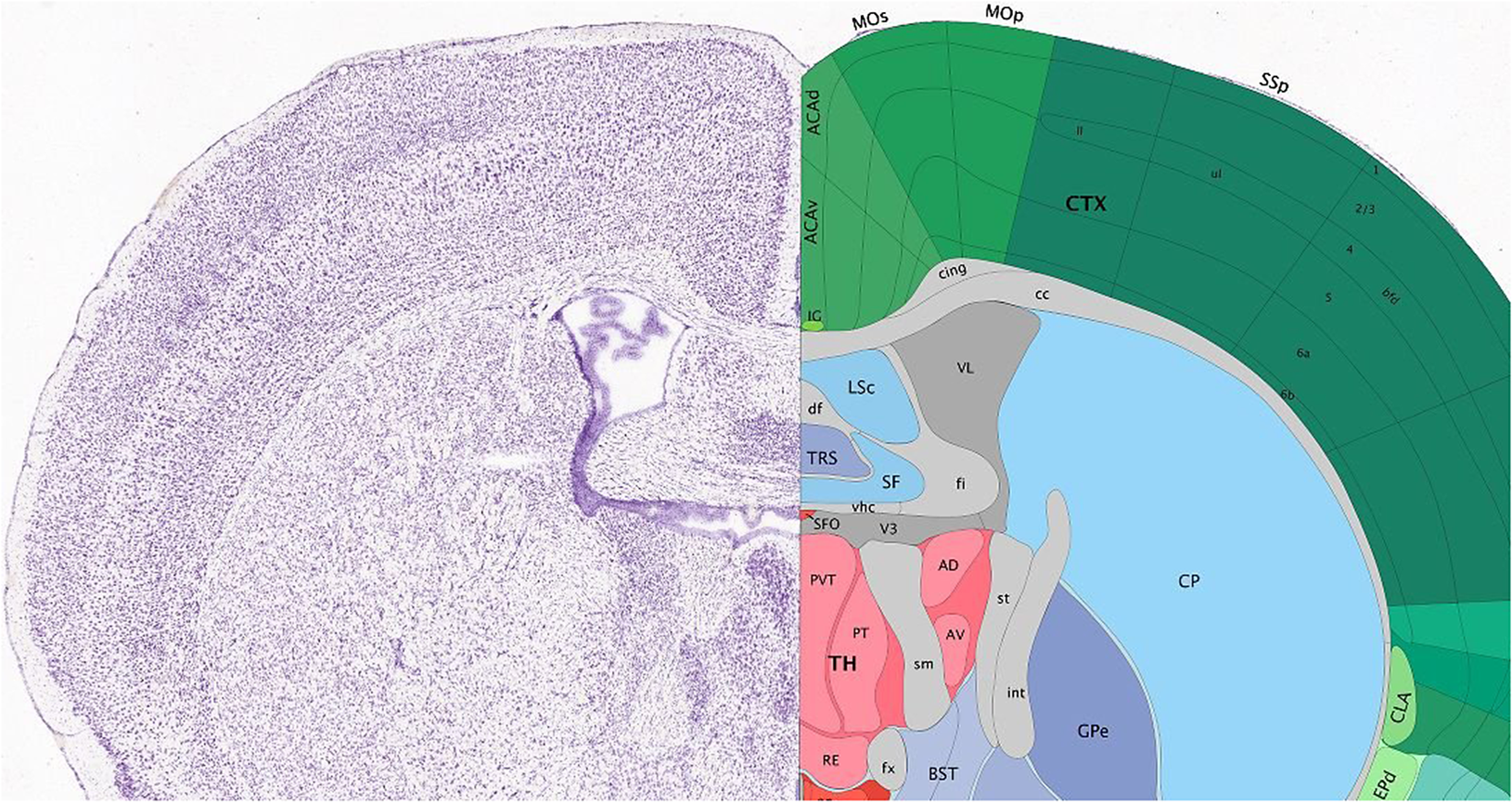 Composite showing a coronal mouse brain section with anatomical regions labeled, including cortex, thalamus, and caudoputamen. See long description.