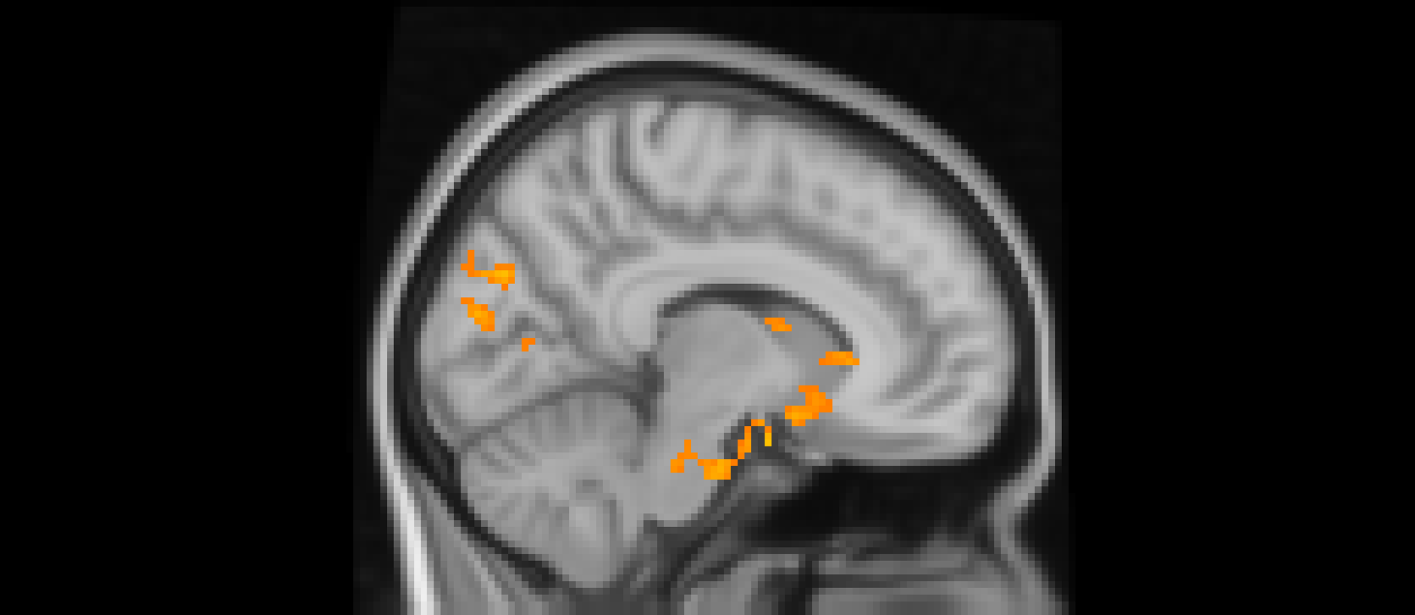 A cross-sectional image of a human brain with highlighted regions.