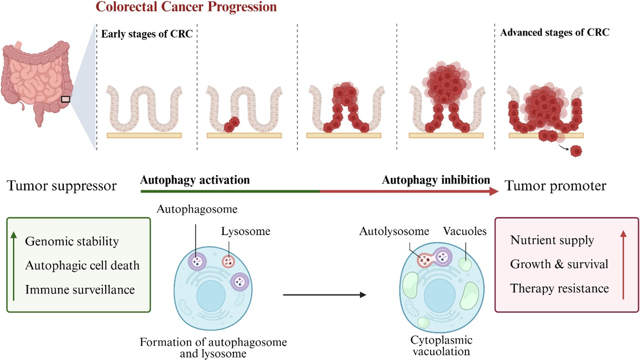 A two-panel schematic showing the progression of colorectal cancer and the dual role of autophagy as both a tumor suppressor and a tumor promoter. See long description.