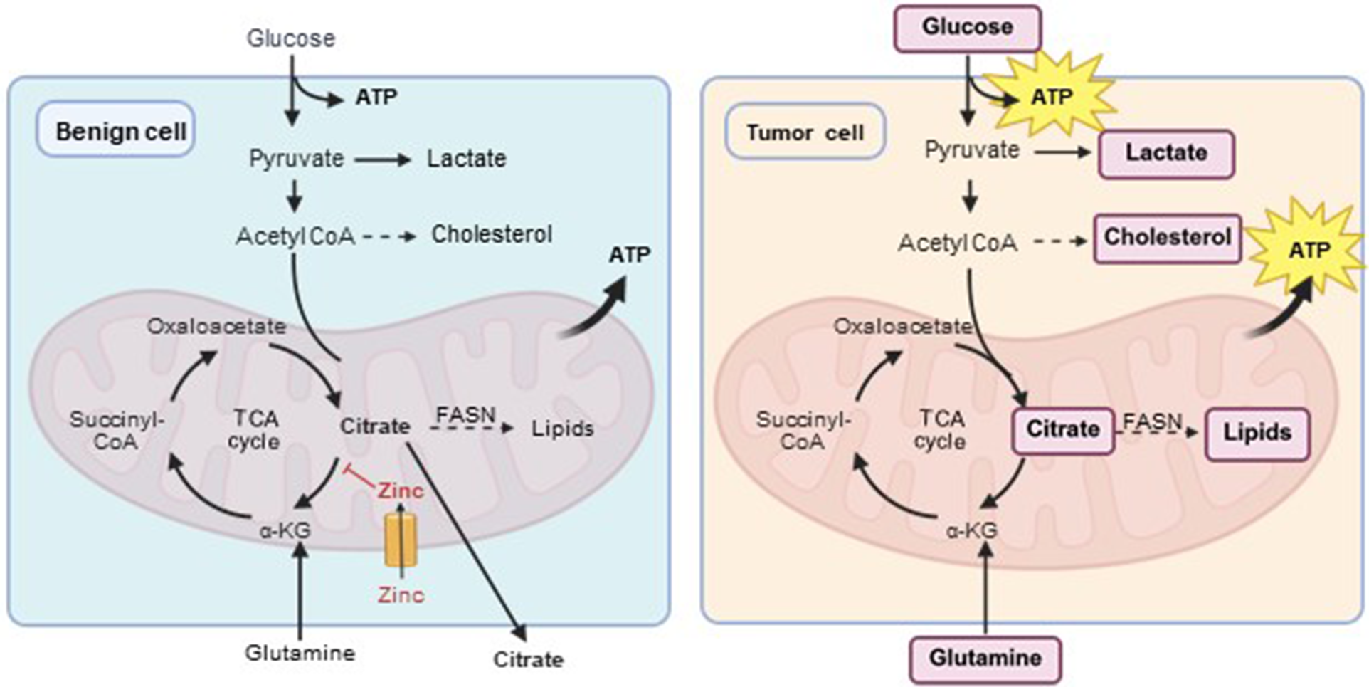 A two-panel flowchart comparing metabolic pathways in a benign cell versus a tumor cell. It highlights differences in citrate utilization and energy production. See long description.