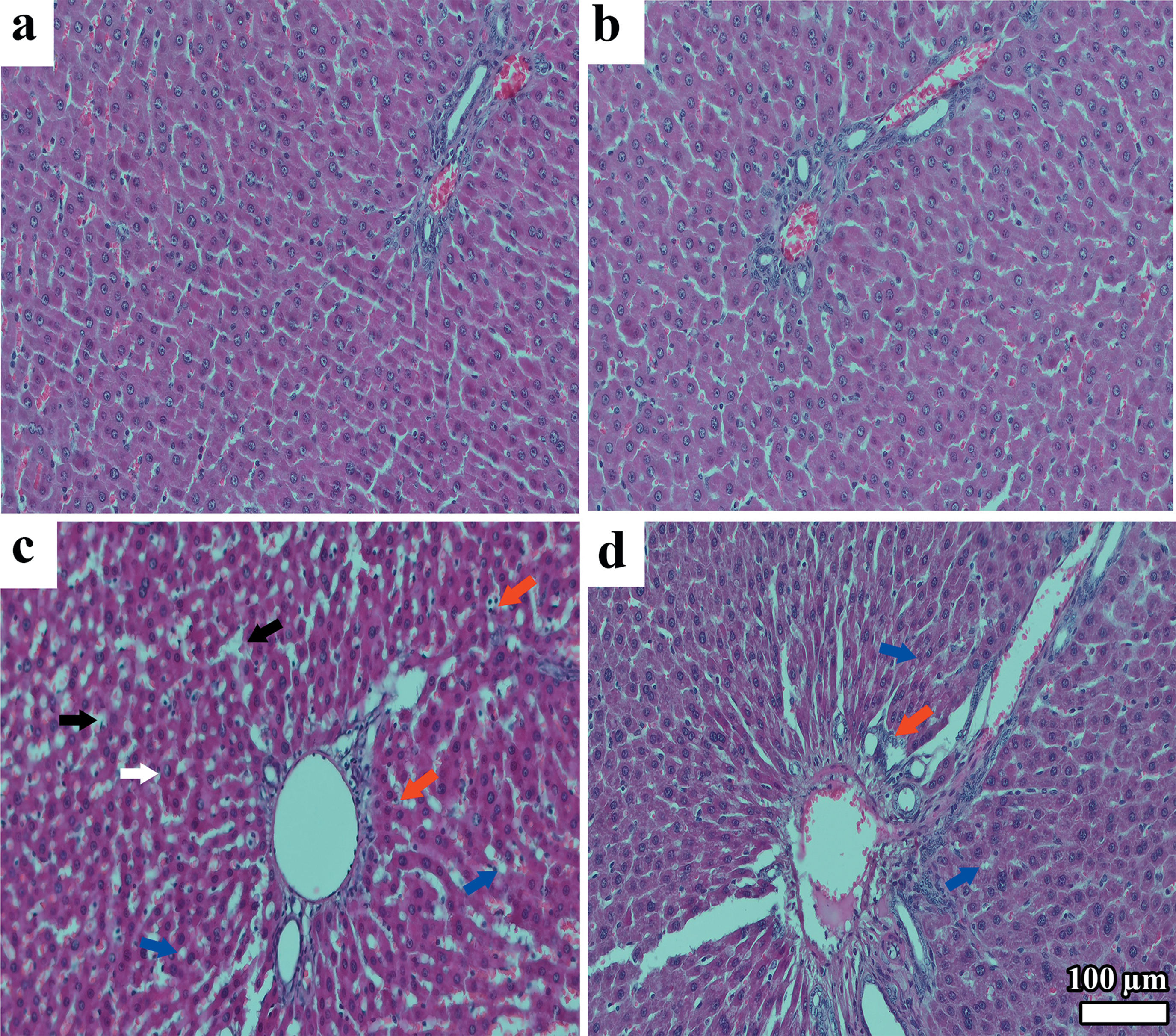 Cross-sectional images of liver tissue under different conditions.