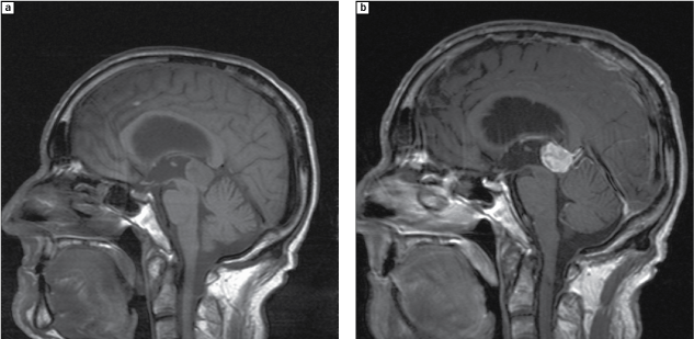 The Midbrain Chapter 4 Clinical Neuroradiology