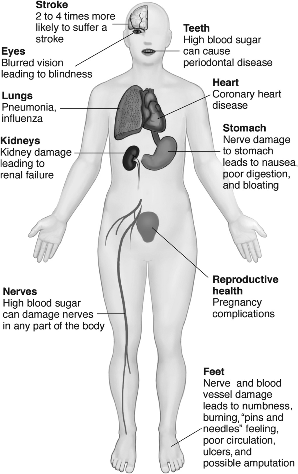 Principles of diabetes mellitus and perioperative glucose control ...