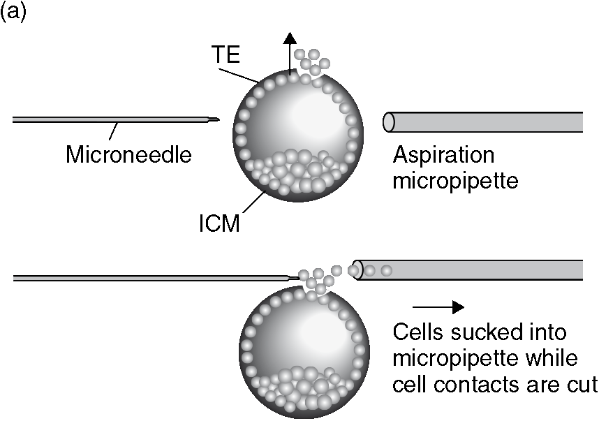 Micromanipulation techniques (Chapter 13) - In-Vitro Fertilization