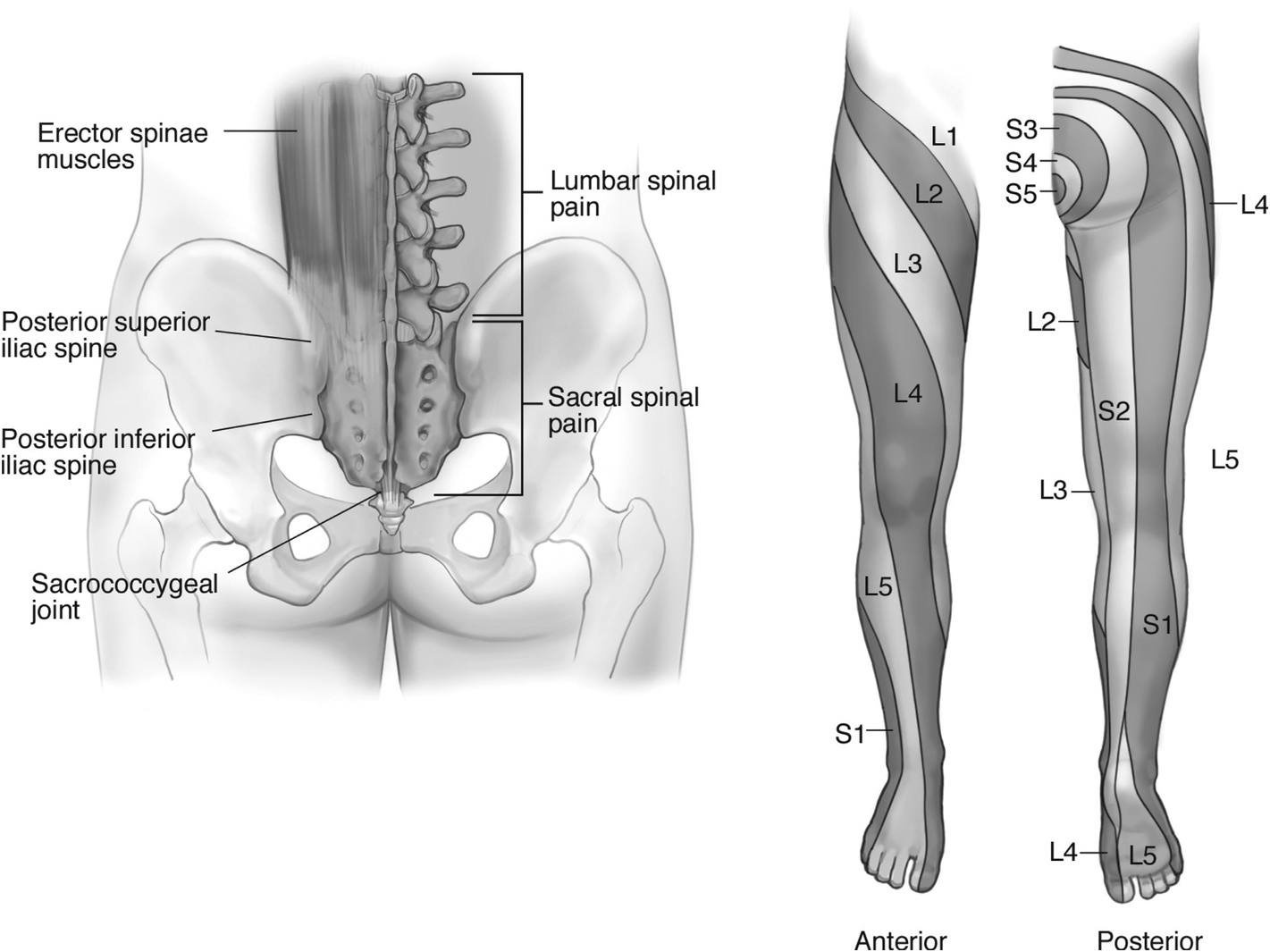 Low Back Pain Linked to Cells in Spinal “Shock Absorbers”