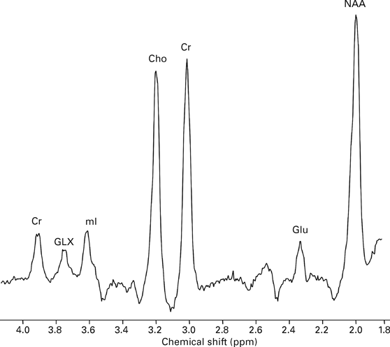 Magnetic resonance spectroscopy: methods and applications in
