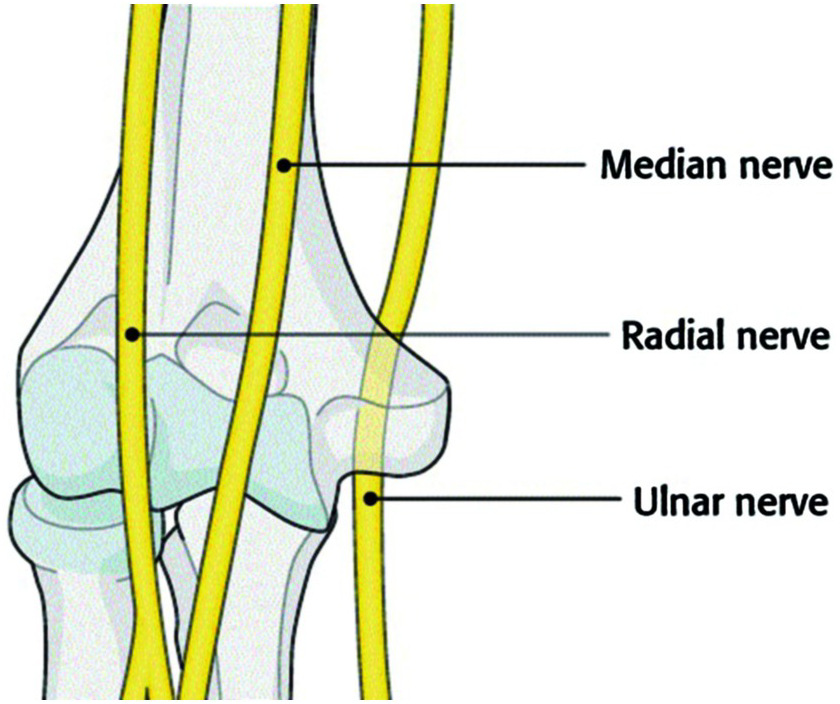 Ulnar Nerve Subluxation, Elbow Surgery Oklahoma City