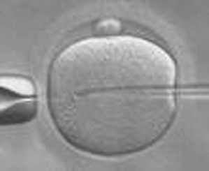 Assisted reproductive technologies (Chapter 2) - Preimplantation ...