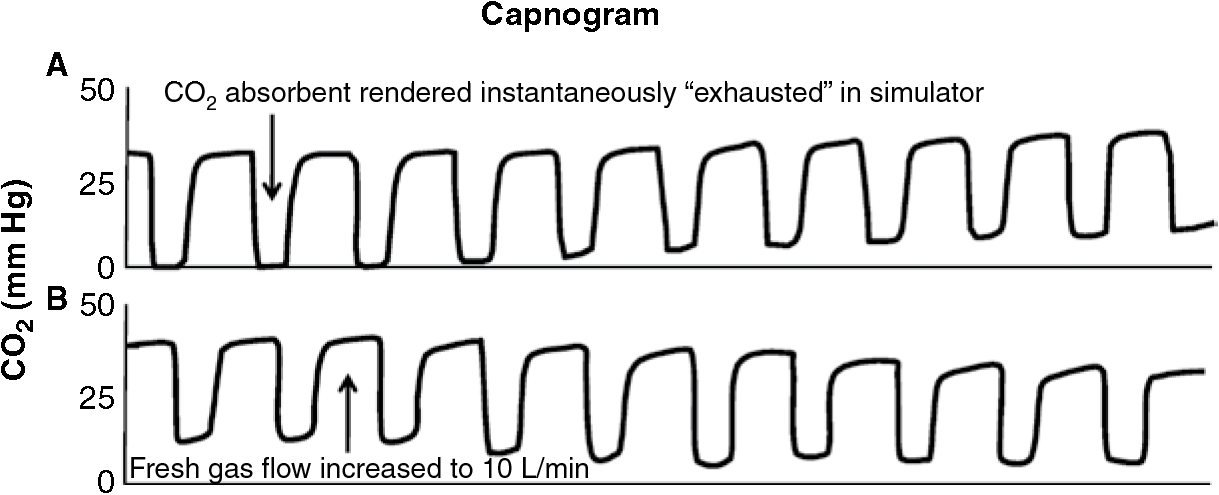 Capnography During Anesthesia (Chapter 6) Capnography