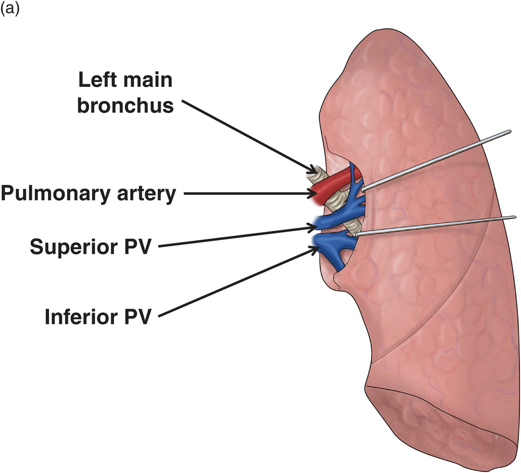 hilum of lung