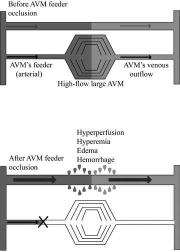 diplopia paul vigil pdf converter