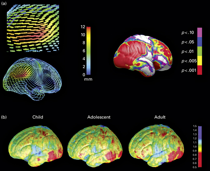 Morphological development of the brain: what has imaging told us