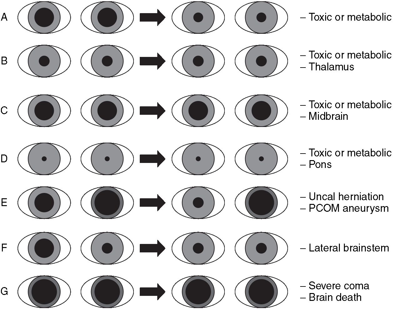 Coma (Chapter 2) - Neurology