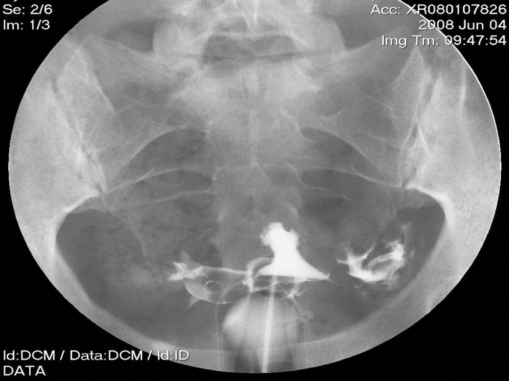 Benign Gynecology Section 2 Ultrasonography In Gynecology Benign Gynecology Section 2 Ultrasonography In Gynecology