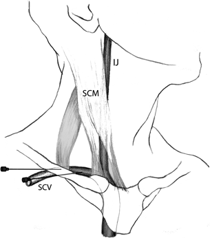 Core Principles In Trauma Anesthesia Section 1 Essentials Of Trauma Anesthesia