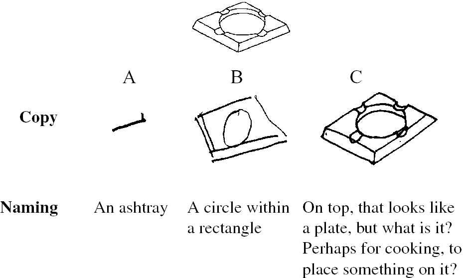 Object and color agnosia (Chapter 20) - The Behavioral and Cognitive Neurology of Stroke Object and color agnosia (Chapter 20) - The Behavioral and Cognitive Neurology of Stroke