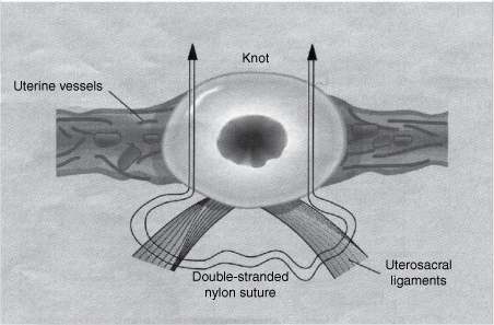 Late Pregnancy Loss Chapter 26 Early Pregnancy