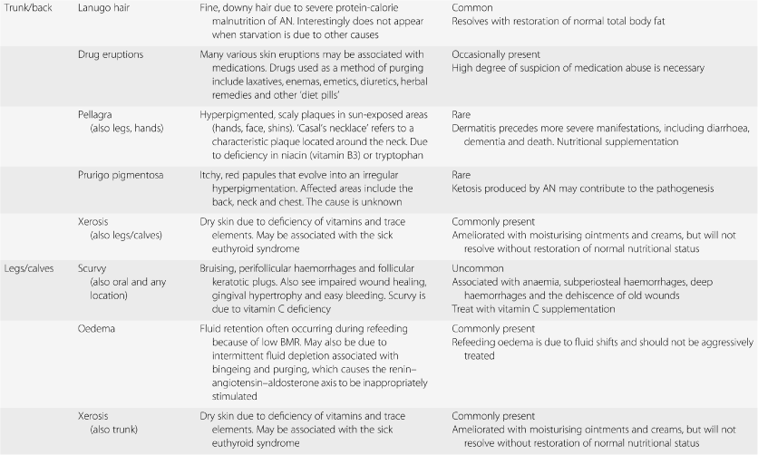 Diagnosis and clinical features (Section 3) - Medical Management of Eating Disorders Diagnosis and clinical features (Section 3) - Medical Management of Eating Disorders