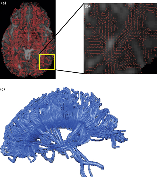 Diffusion tensor imaging in developmental clinical neuroscience