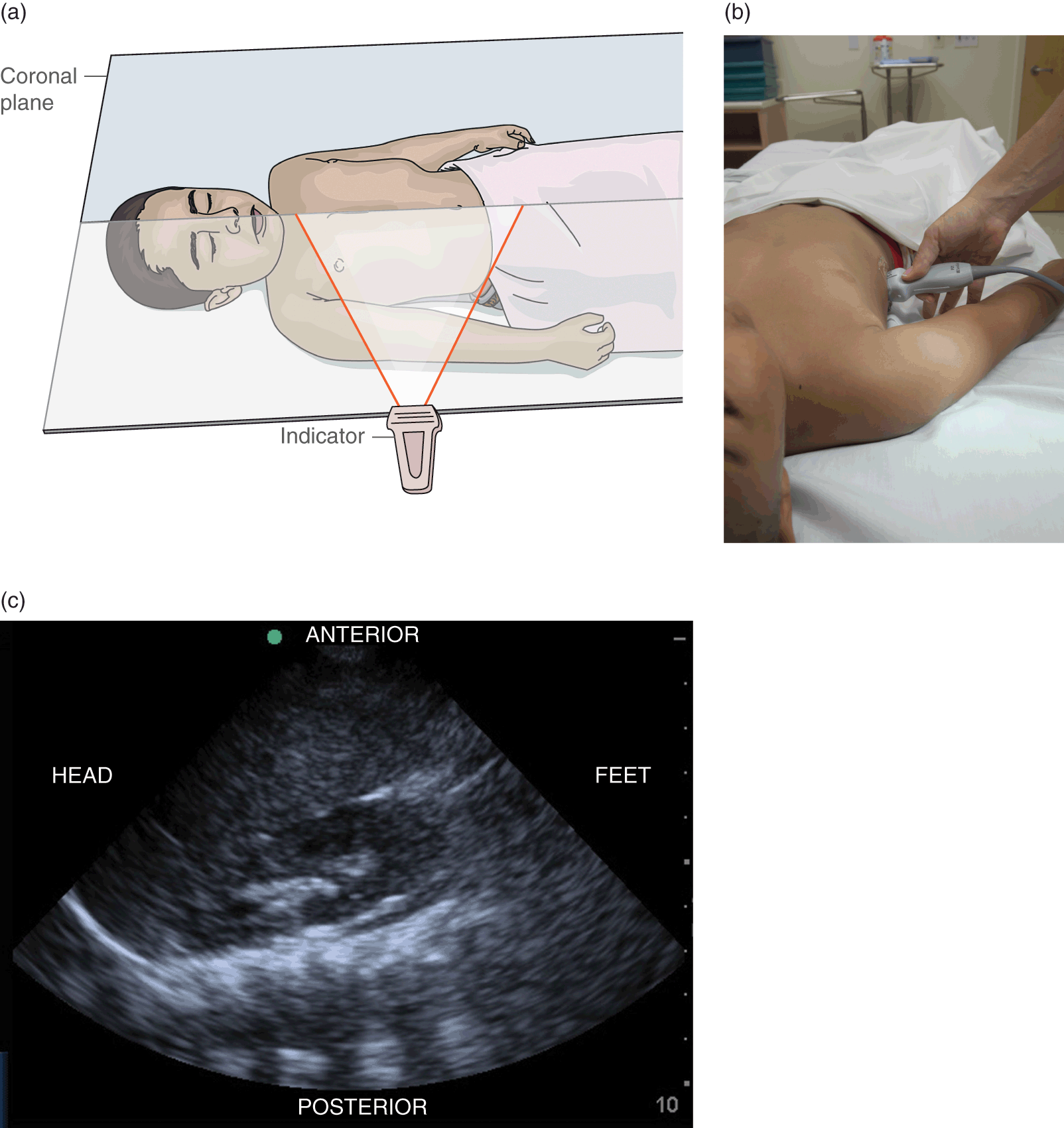 Diagnostic ultrasound (Section 2) - Pediatric Emergency Critical Care and  Ultrasound