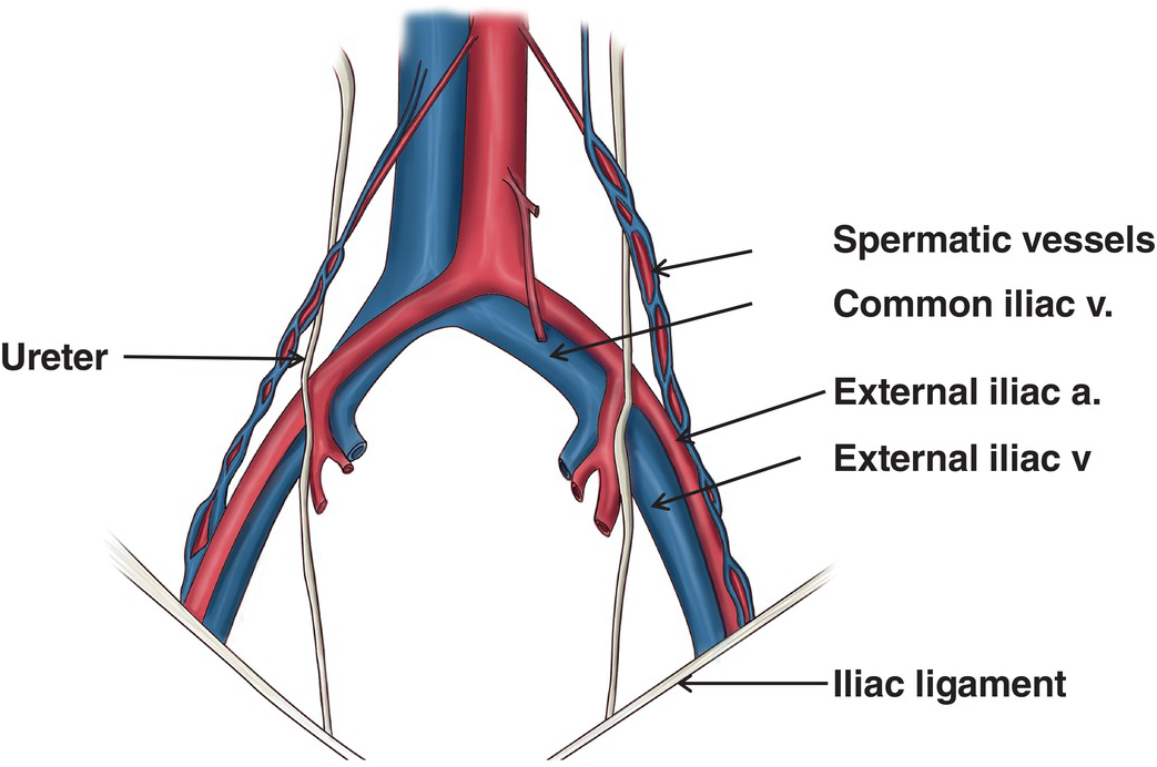 The Pelvic Veins External Internal Common Iliac Teach - vrogue.co