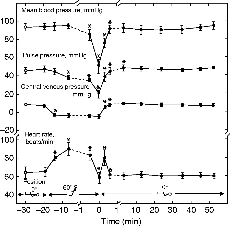 hypovolemic shock chart