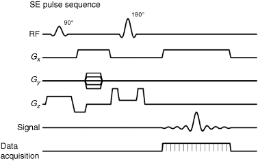 Pulse sequence diagram of the balanced steady-state free