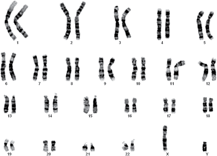 Parental Chromosome Testing Chapter 11 Early Pregnancy