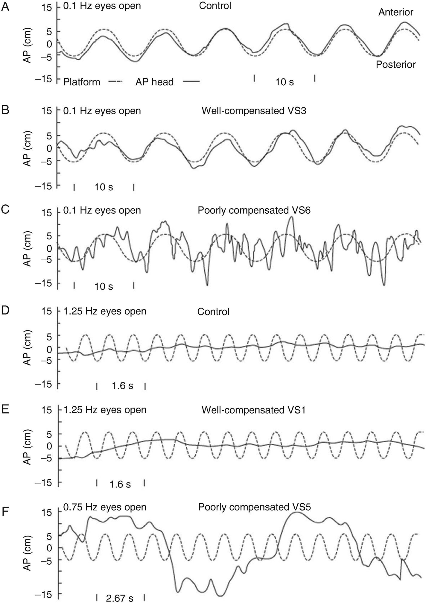 Symptom-specific neurorehabilitation: sensory and motor