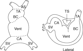 Download Cardiac Embryology And Anatomy Chapter 1 Core Topics In Cardiac Anesthesia