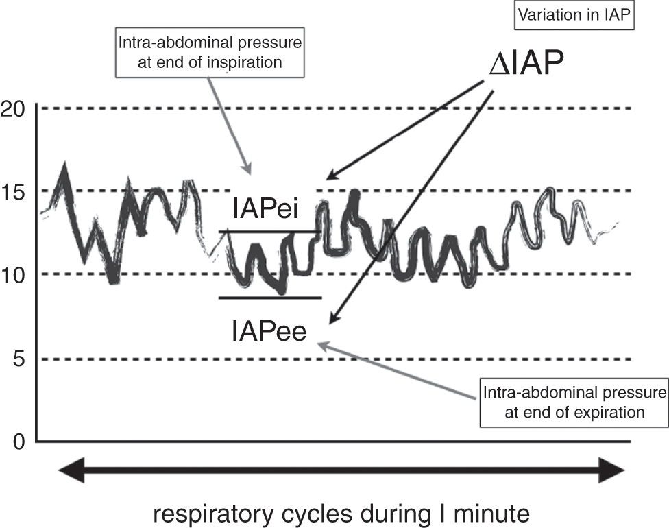 What is normal intra-abdominal pressure and how is it affected by  positioning, body mass and positive end-expiratory pressure?